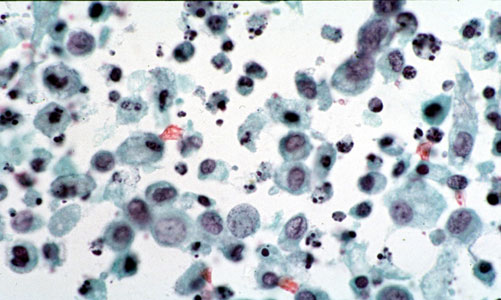 Cytopathology